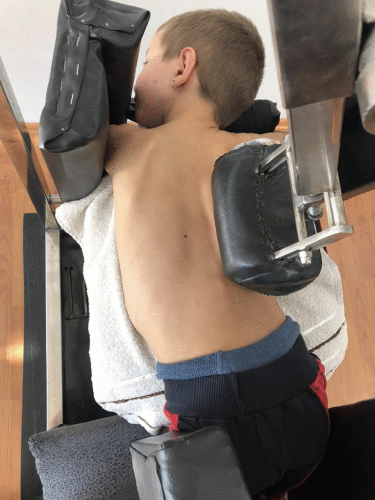Delfin sprava – pacijent tokom terapije skolioze u centru za skoliozu